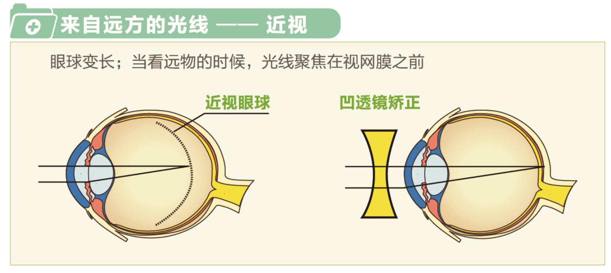 近视玩主机